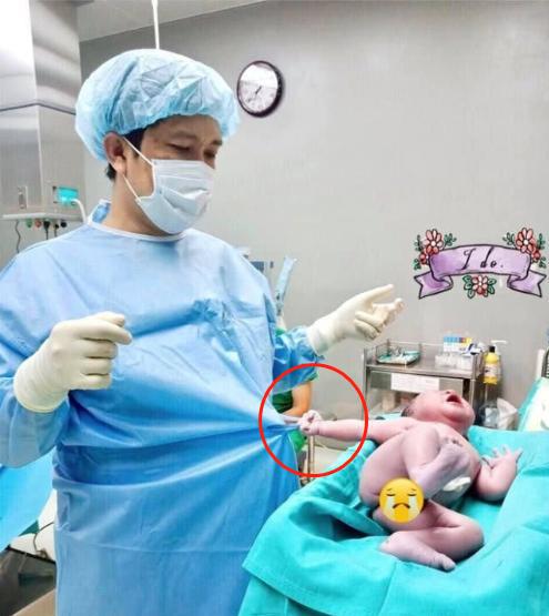 刚出生的婴儿拉住医生的手术服,照片萌翻网友 刚刚是你打我屁股