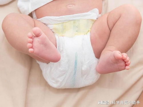 新生儿宝宝的肚脐如何护理