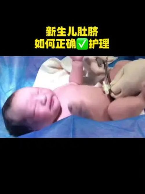 新生儿肚脐如何正确护理,新生爸妈赶紧收藏学起来 新生儿 脐带掉落 肚脐贴 母婴好物