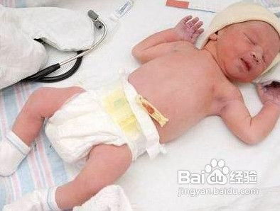 夏天怎么护理新生儿