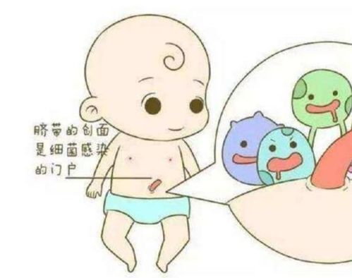 新生儿脐带护理全攻略 如何正确使用护理液