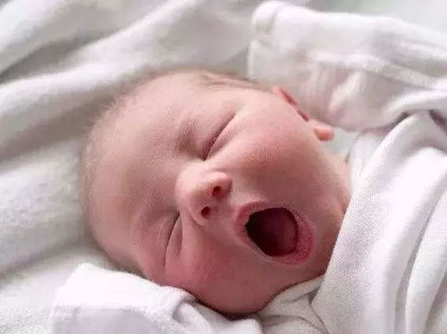 0-1岁宝宝常见疾病护理要点 黄疸、肺炎、鹅口疮、湿疹及脐带护理